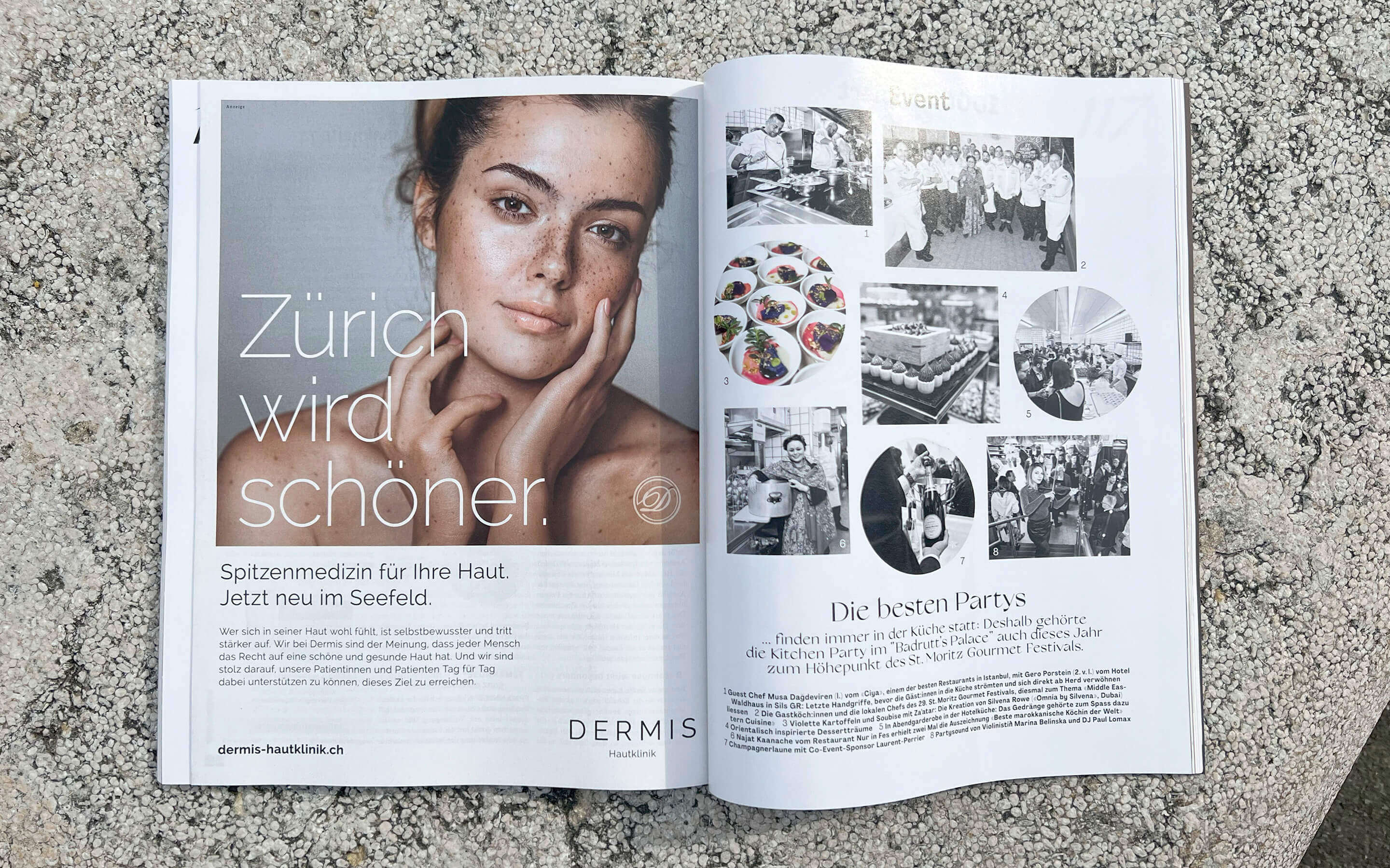 Dermis in der Annabelle